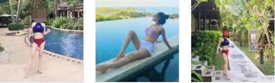 广州韩妃整形吸脂瘦大腿案例