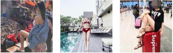 广州韩妃整形吸脂瘦大腿案例