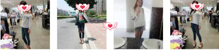 福州美贝尔整形赵栋材做吸脂瘦大腿案例