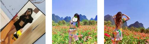 重庆好美整形罗海军医生吸脂瘦腹部案例