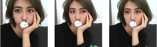 南宁伊丽莎白整形鼻综合案例