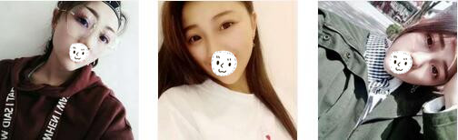 贵阳美贝尔整形双眼皮案例