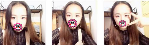 深圳恩吉娜整形半永久眉术案例