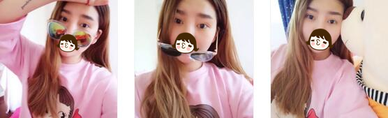 成都米兰柏羽整形双眼皮案例