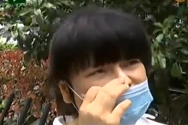 歪鼻矫正经验