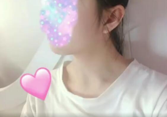 单眼皮女孩的双眼皮梦想